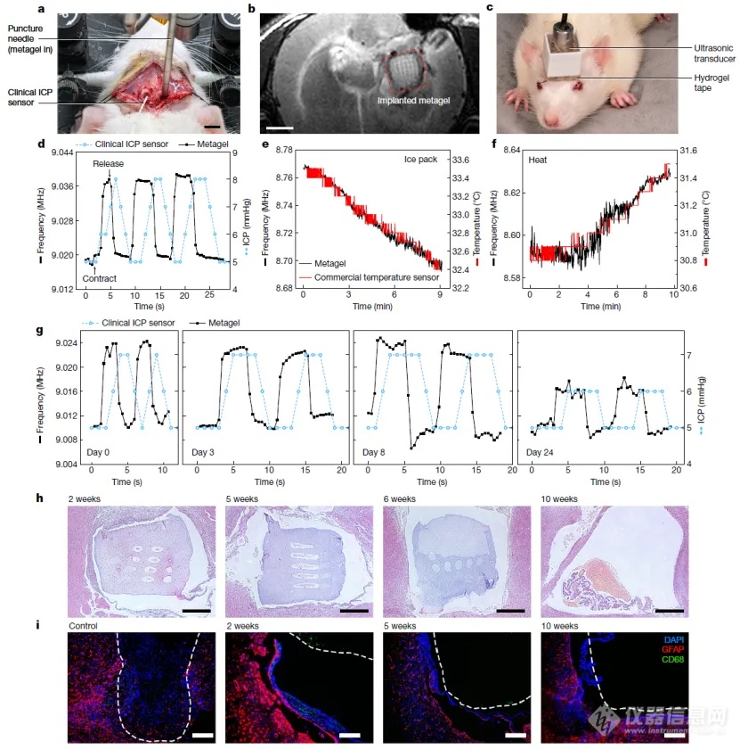 重磅！华中科技大学等再发《Nature》研发出“颅内生理信号监测黑科技”！(图4)