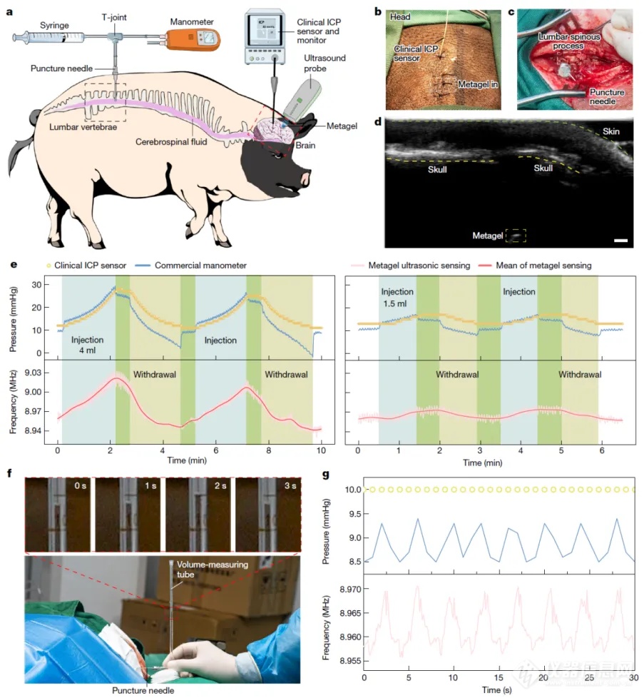 重磅！华中科技大学等再发《Nature》研发出“颅内生理信号监测黑科技”！(图5)